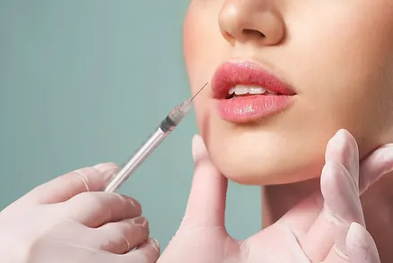 Lip Filler 45 min - $600